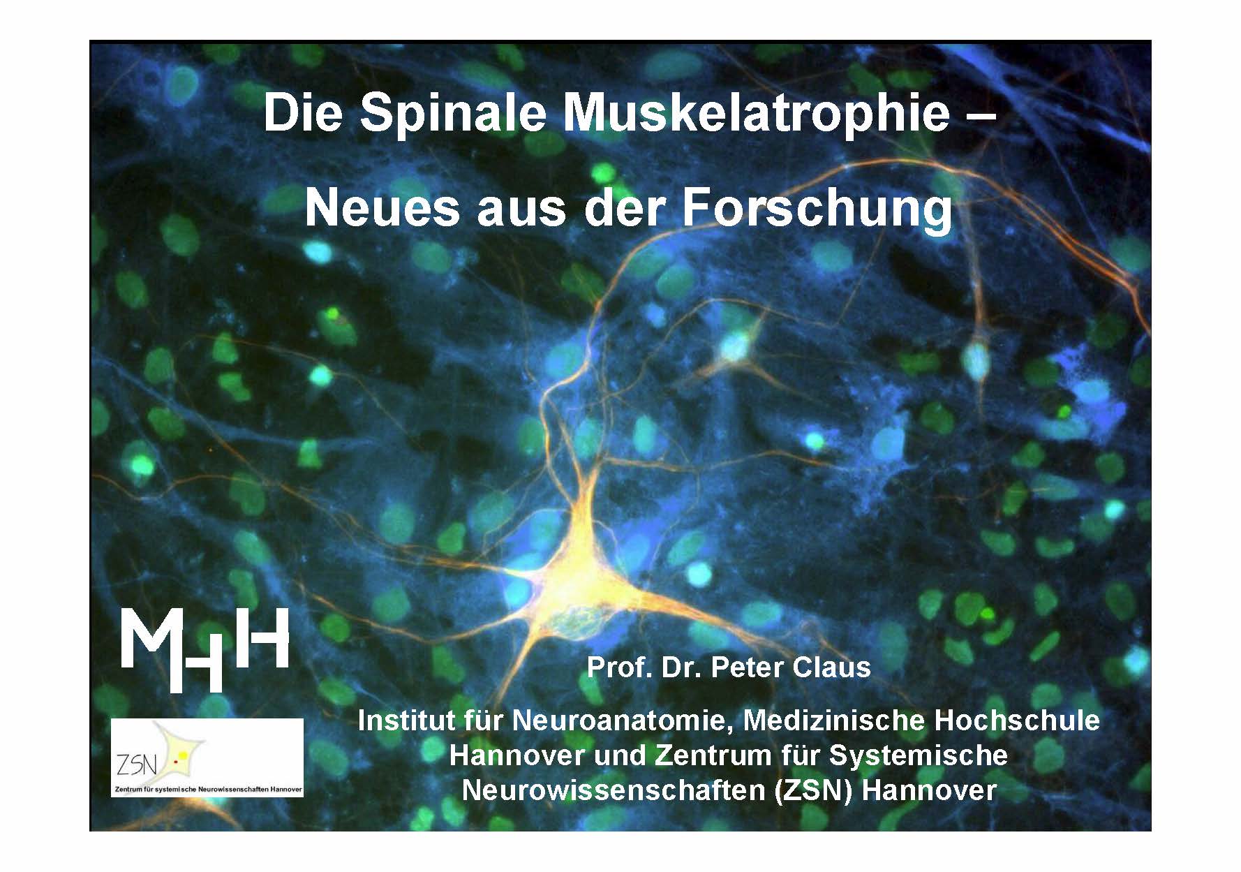 Vortrag Prof. Dr. Peter Claus, MHH, SMA-Treffen Hochwald September 2012